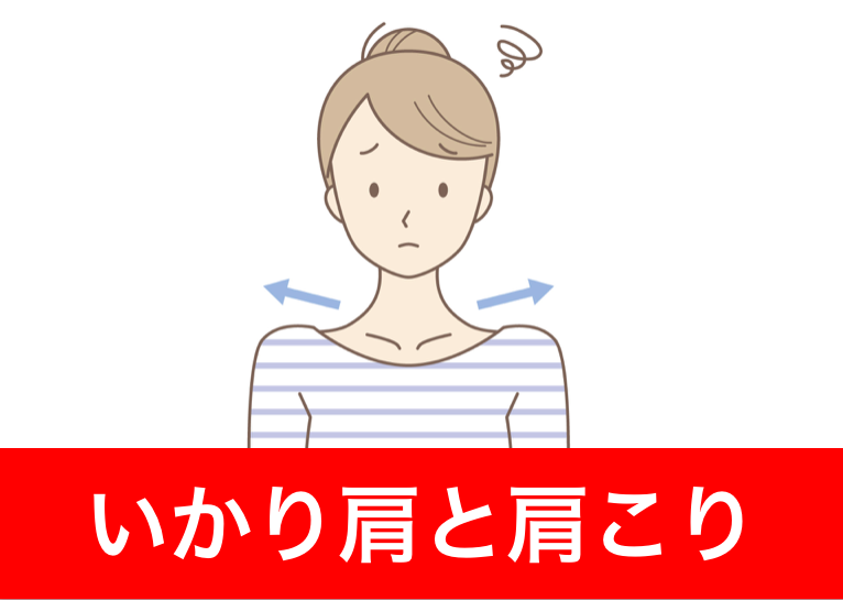いかり肩と肩こり